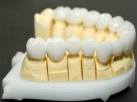 Zirconiu coroana dentara