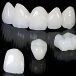 A collection of zirconia crowns and prostheses showcasing the quality and aesthetics of modern dental solutions at Dent VIP Clinic in Chișinău, Moldova