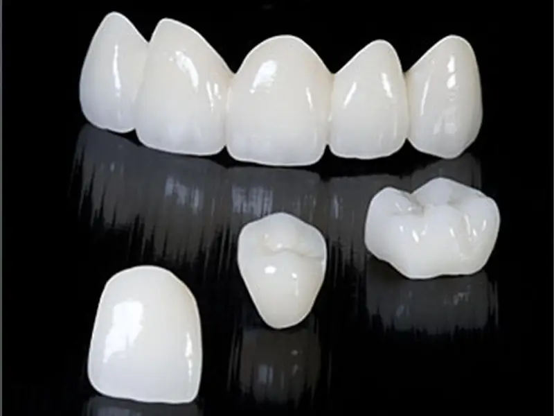 A collection of zirconia crowns and prostheses showcasing the quality and aesthetics of modern dental solutions at Dent VIP Clinic in Chișinău, Moldova